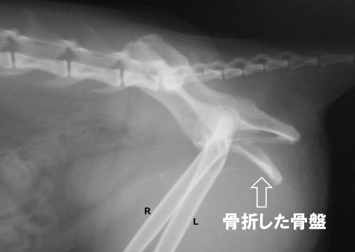 治療 仙骨 骨折 仙骨、坐骨骨折の痛みが続く期間について