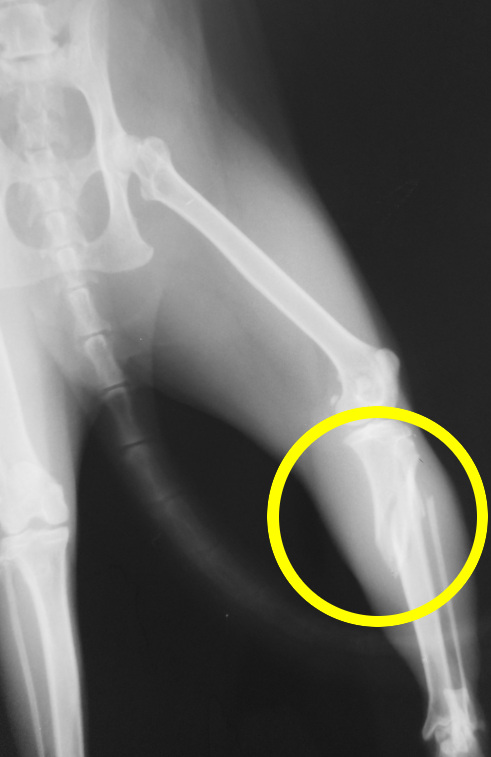 DSCN3923 VD tibial fracture