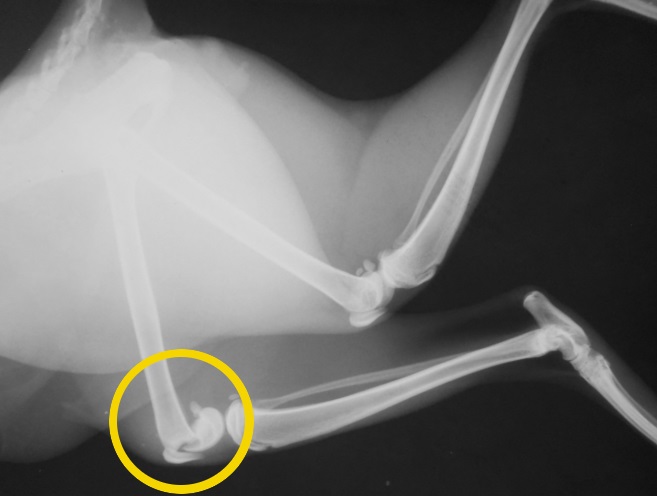 DSCN4062 LL epiphysial fracture in the left femur BW